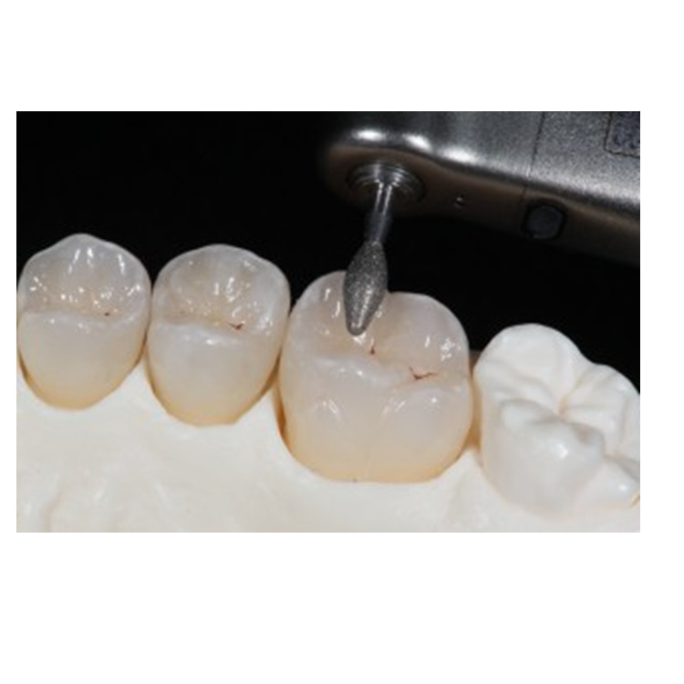 VHF Amann Arum Dental Milling Burs CAD CAM Milling Cutter 0.6mm 2.0mm 2.5mm