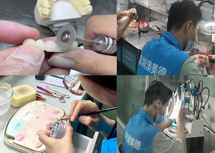 Translucency Zirconia Dental Crown with Aesthetic Performance from China Dental Lab