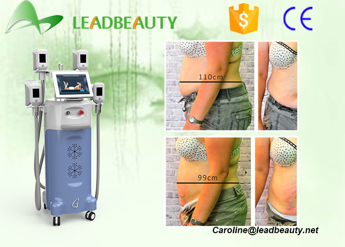 Beijing supplier / cryolipolysis slimming equipment /cryolipolysis slimming machine