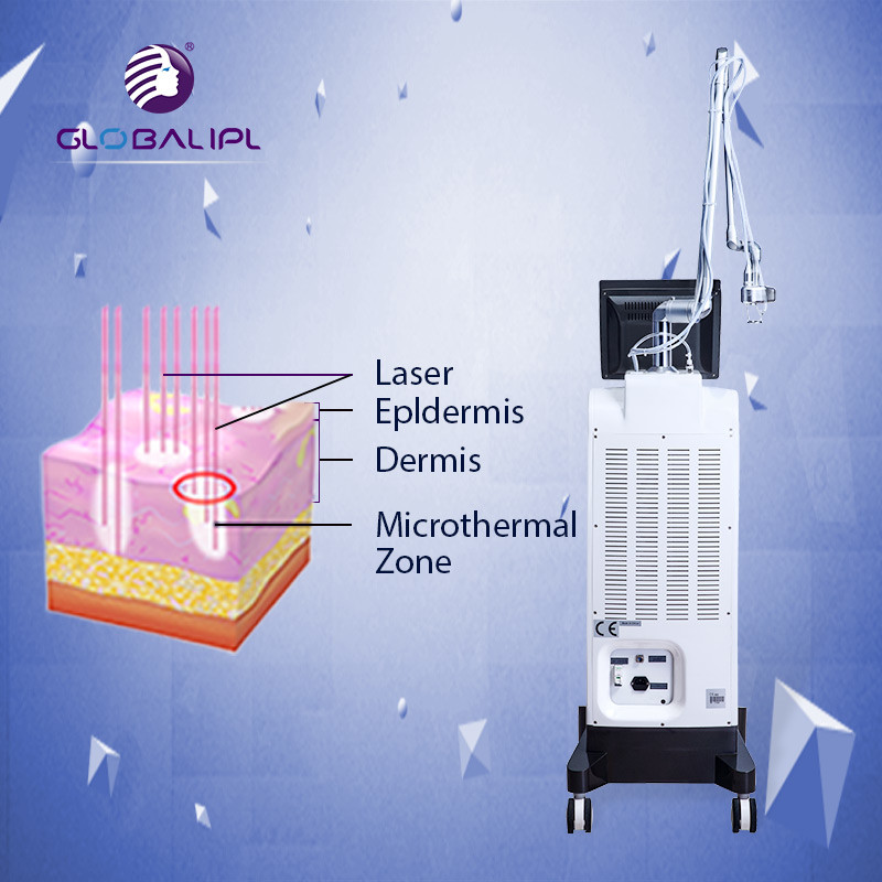 3 In 1 CO2 Fractional Laser Machine Acne Scar Removal Vaginal Tightening Machine