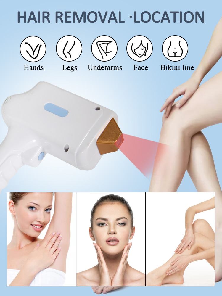 Portable 808nm Diode Laser Hair Removal Machine For Home
