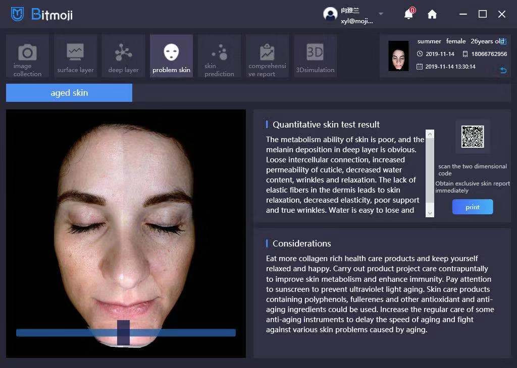 Passed ROHS Portable Professional Face Skin Analyzer