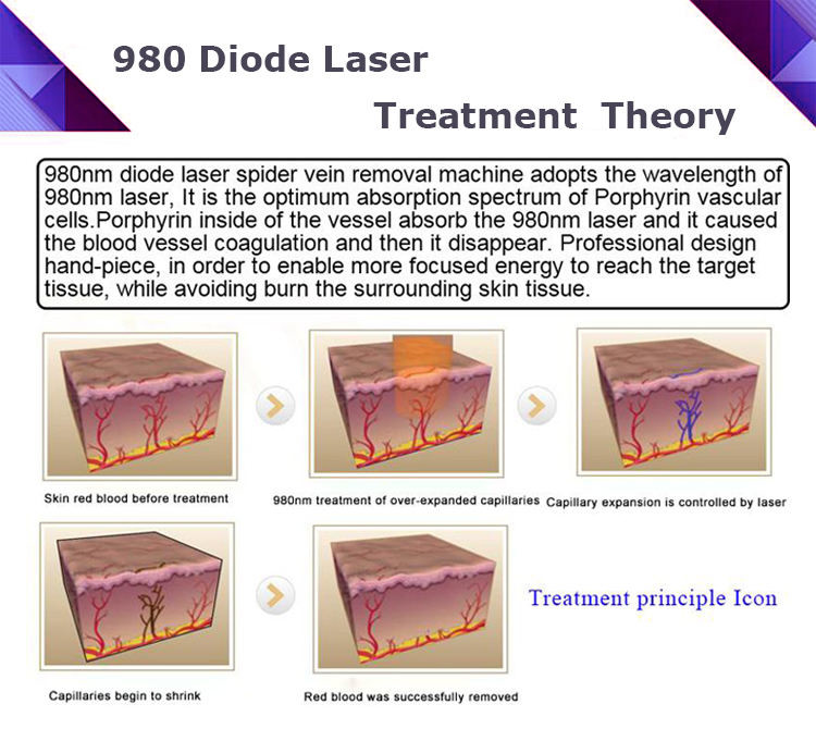 30W 100ms Spider Veins Removal Machine 980 Nm Diode Laser For Vascular Removal