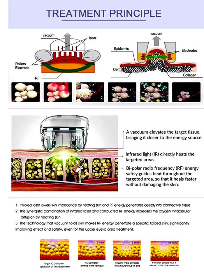 V9 Cellulite Reduction Machine , RF Non Surgical Liposuction Machine