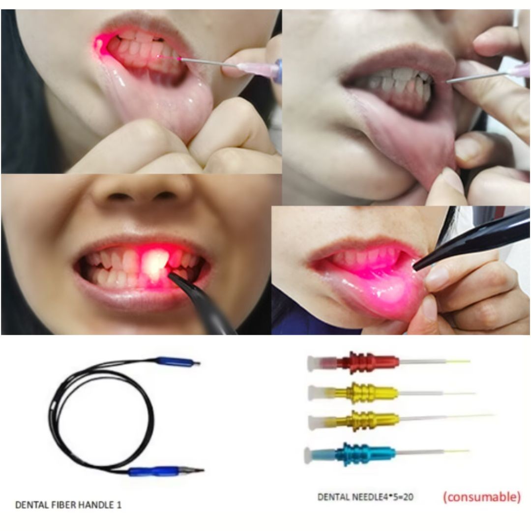 650nm 980nm Teeth Diode Laser In Dentistry For Periodontics Endodontics Soft Tissue Surgery