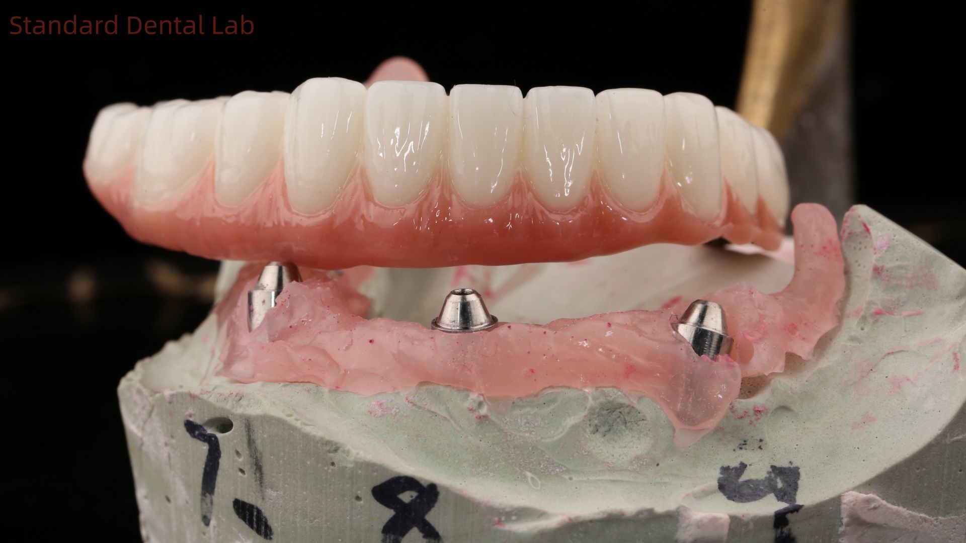 High Quality Dental zirconia crown and All On Four Six Implant Full Arch / China dental lab Manufacturer