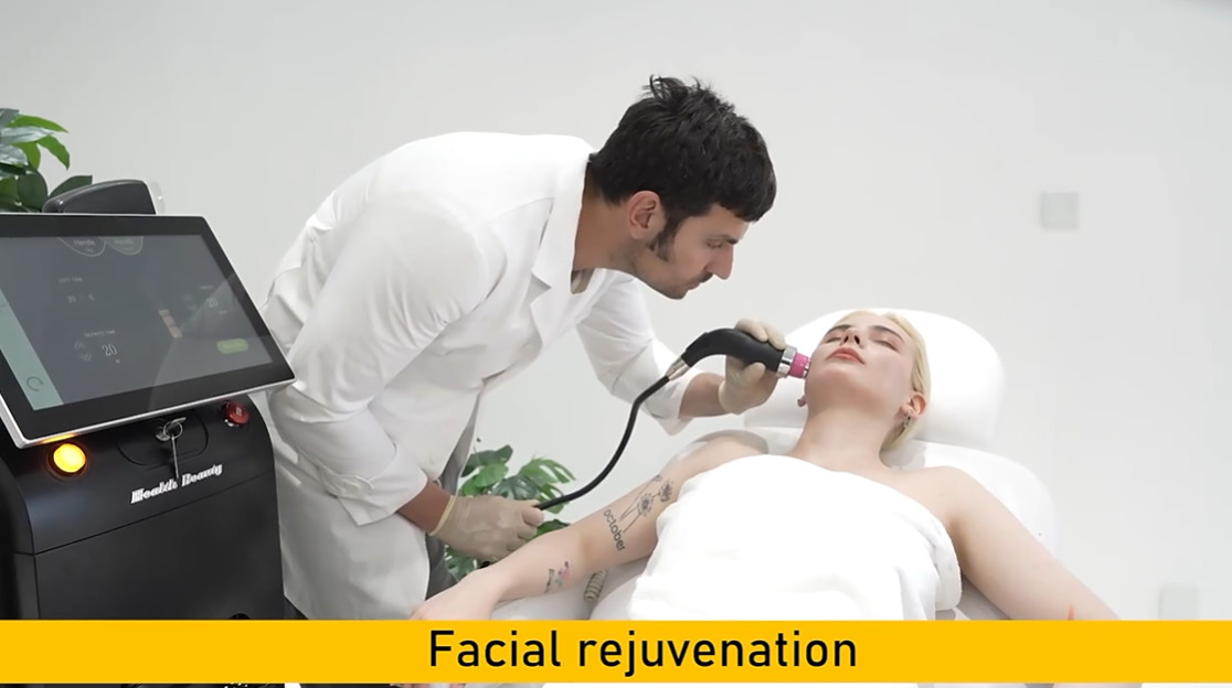 Multifunctional IPL RF DIODE LASER ND YAG LASER tattoo removal and hair removal skin rejuvenation salon use