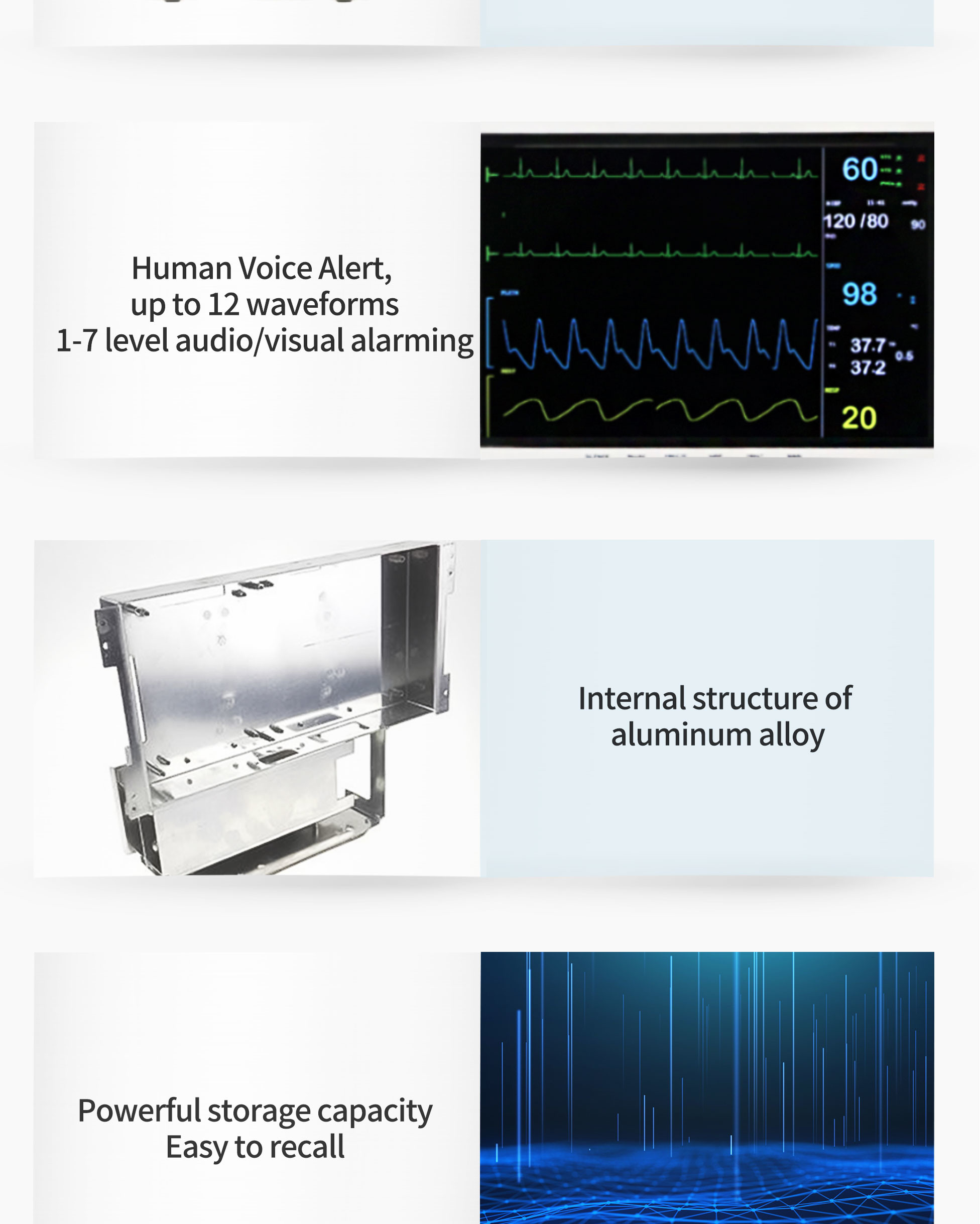 2000 Piece Trend And Data Storage 12 Inch Multi Parameter Patient Monitor