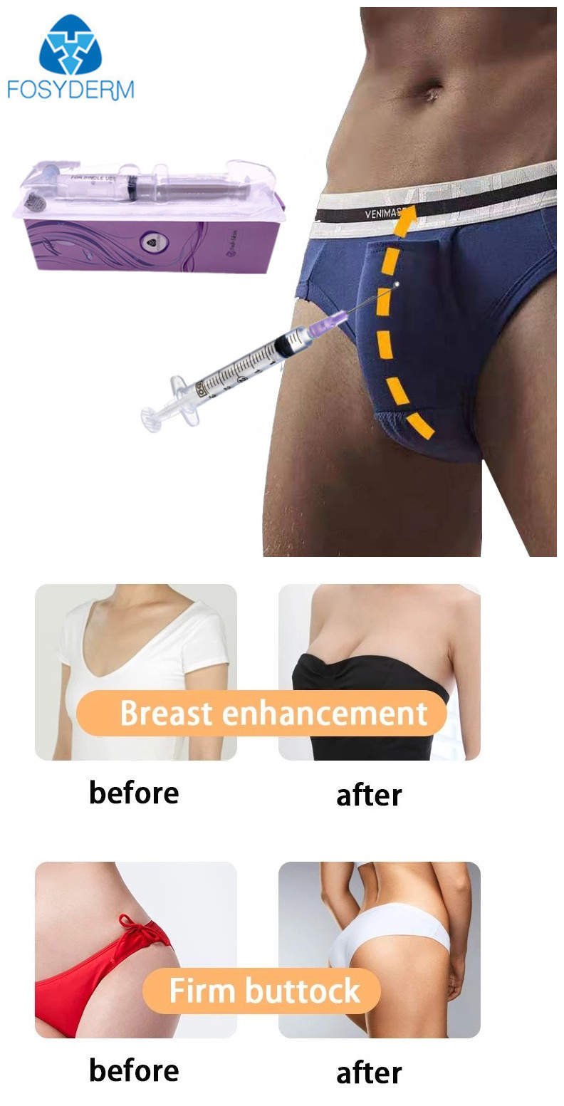 24mg/Ml Hyaluronic Acid Dermal Filler For Breast Penis Enlargement