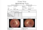 CE Medical Digital Fundus Camera Resolution 1920 X 1080 Pixels