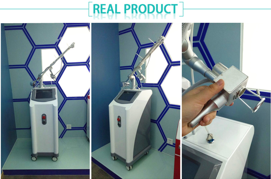 best stretch mark removal after brith recover verginal tightenig fractional C02 laser machine