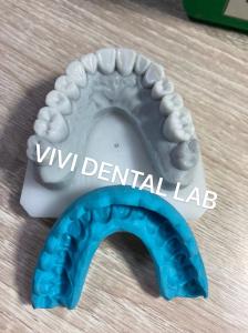 China Stable Dental Crown Diagnostic Wax Up For Orthodontic Treatment on sale
