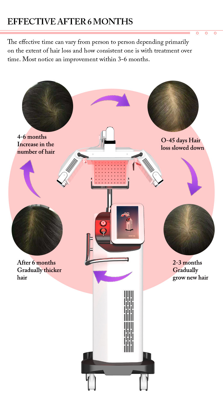 660nm Diode Laser Hair Growth Machine , Anti Hair Loss Treatment Machine
