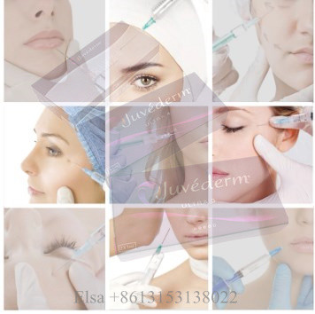 Juvederm Ultra4 Dermal Filler Lip filler Facial Lifting Ha Gel Injection