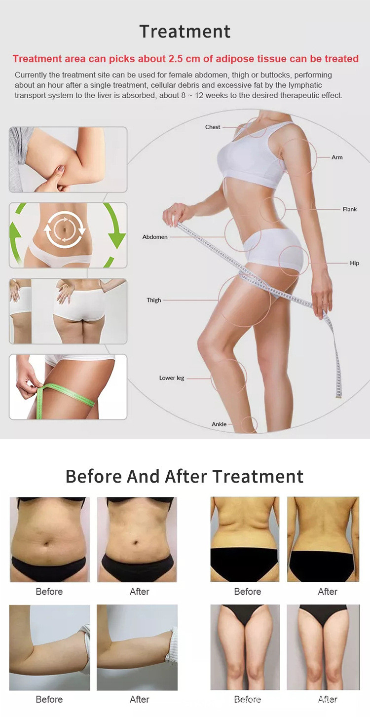 Liposonic Ultrasound HIFU Beauty Machine 0.8cm 1.3cm Cellulite Reduction