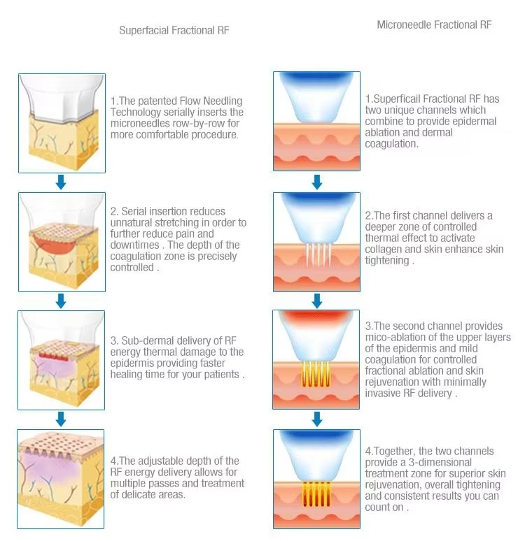 Fractional Rf Microneedling Cool Harmmer Fade Fine Lines Machine