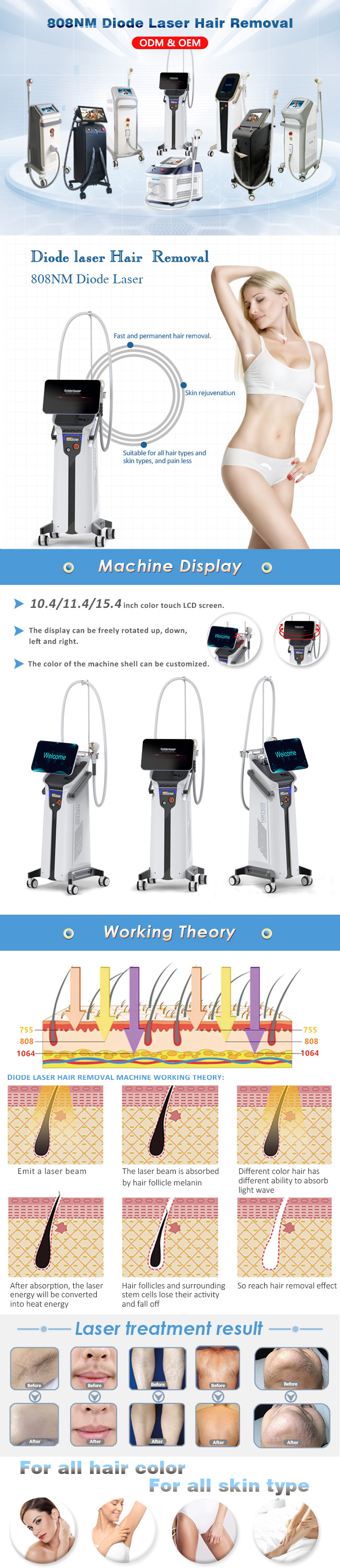 5ms 808nm Diode Laser Hair Removal Machine Alma Laser Soprano Ice Platinum
