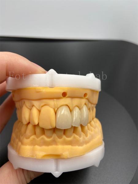 Precision Fit Digital Crowns Implant Dentrues With Compatibility Email