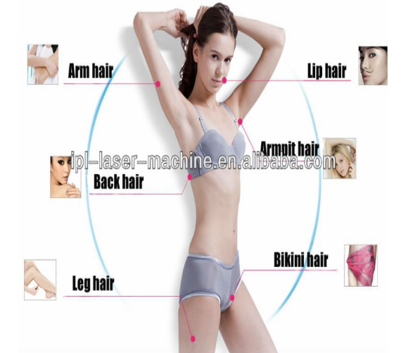 nice epilator diode laser 808diode laser hair removal 808 germany808nm diode laser permanent depilation