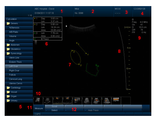 4D Color Doppler Ultrasound Scanner with 3.5MHz / R40 Volume Probe