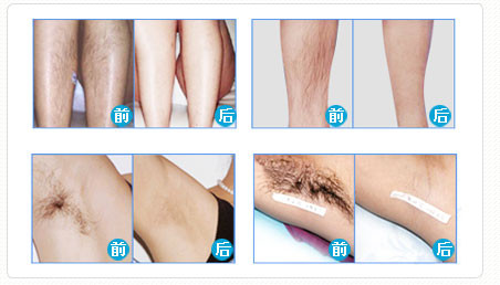 2 In 1 IPL ELIGT Q-SWITCH ND YAGHair Removal Machine With 8.4 Inch Touching Screen