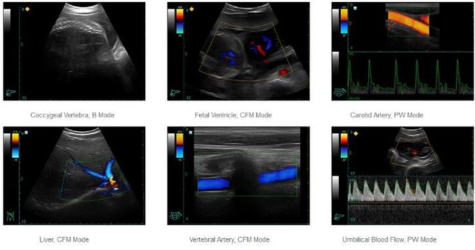 Color Doppler Ultrasound System Portable Ultrasound Scanner With 12.1 Inch LED Monitor And 2 Probe Ports
