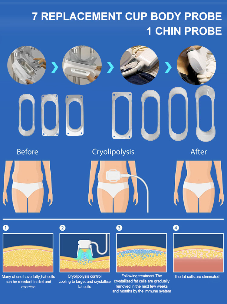 Cryolipolysis Machine Cryo Lipolaser RF Cavitation 4 In 1 Fat Freezer System For Body Slimming