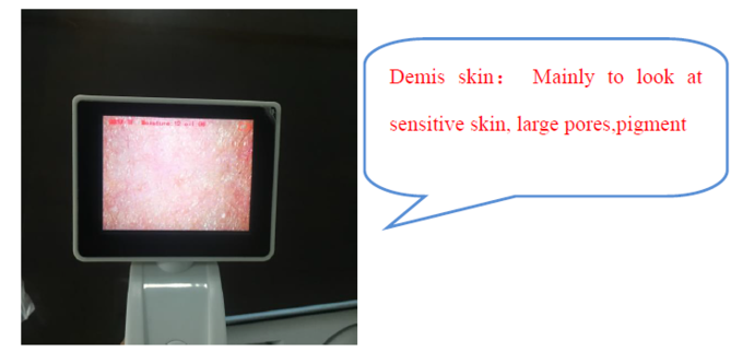 CE BS5SH Digital Skin Analyzer Digital Skin Moisture Meter For Doctor