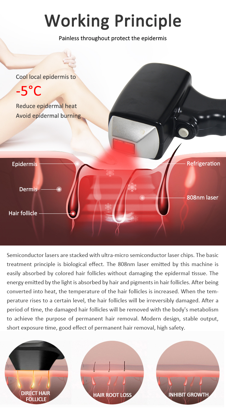 2000w Professional Laser Hair Removal Machine 808 Diode LCD Touch Screen ODM