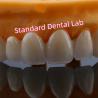 Buy cheap Anterior Restoration Zirconia Bridge Crowns For Missing Teeth from wholesalers