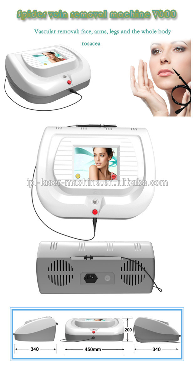spider vein removal machine V600.jpg
