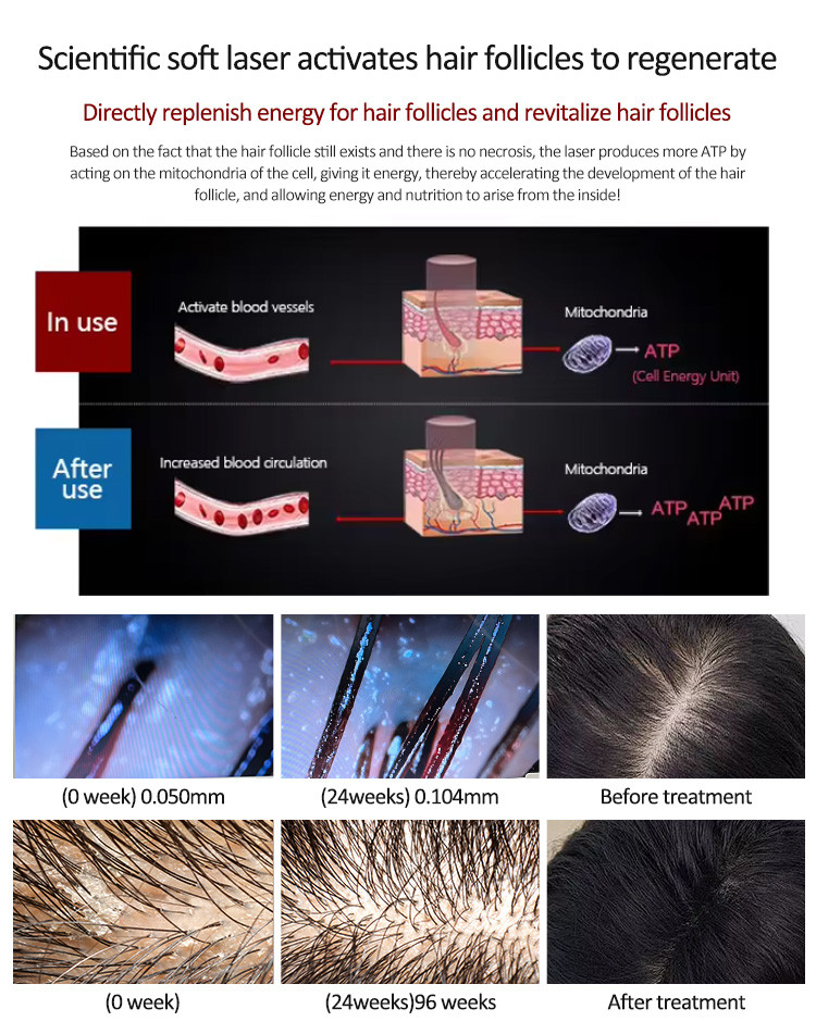 650nm 6 In 1 Laser Hair Growth Device For Scalp Care / Hair Regeneration