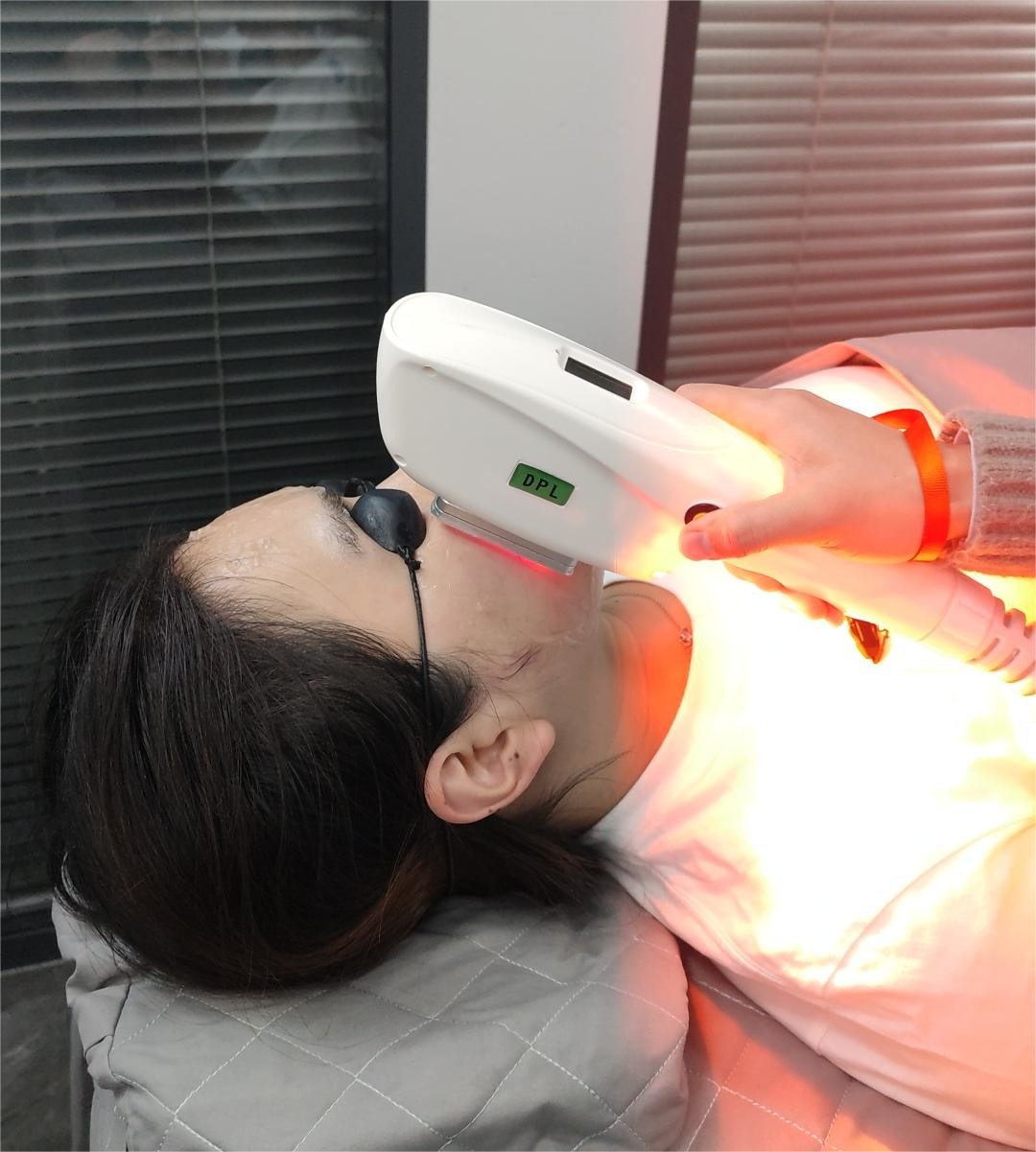 Advanced IPL SHR Elight Machine for Skin Rejuvenation Energy 10-50J/cm2 IPL Frequency 1-10Hz