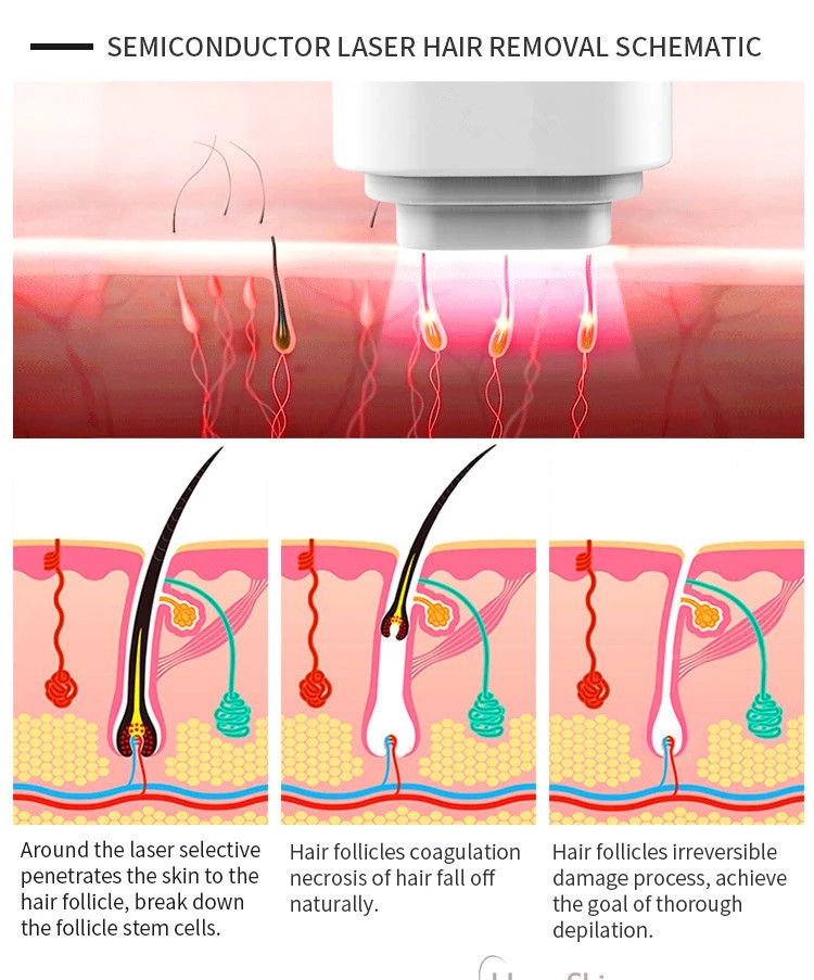 808 Laser Beauty Equipment Diode Painless Fast Hair Removal Machine