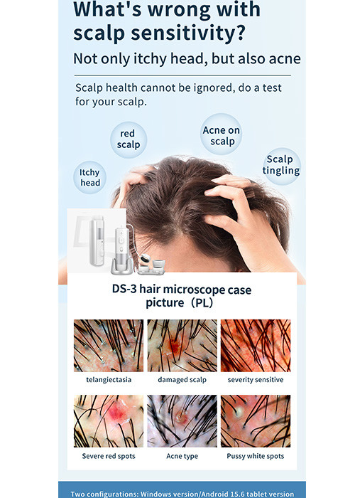 Hair And Scalp Analysis Machine , Skin Diagnosis Hair Analyzer Machine