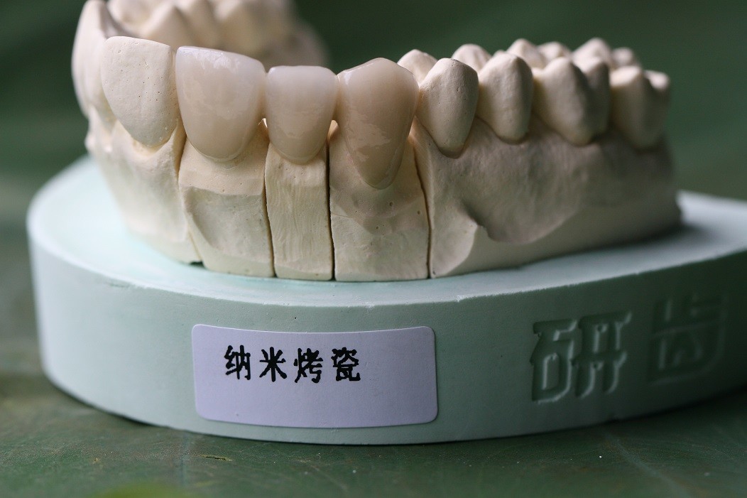 ISO13485 Good Biocompatibility PFM Non Precious Dental Crown