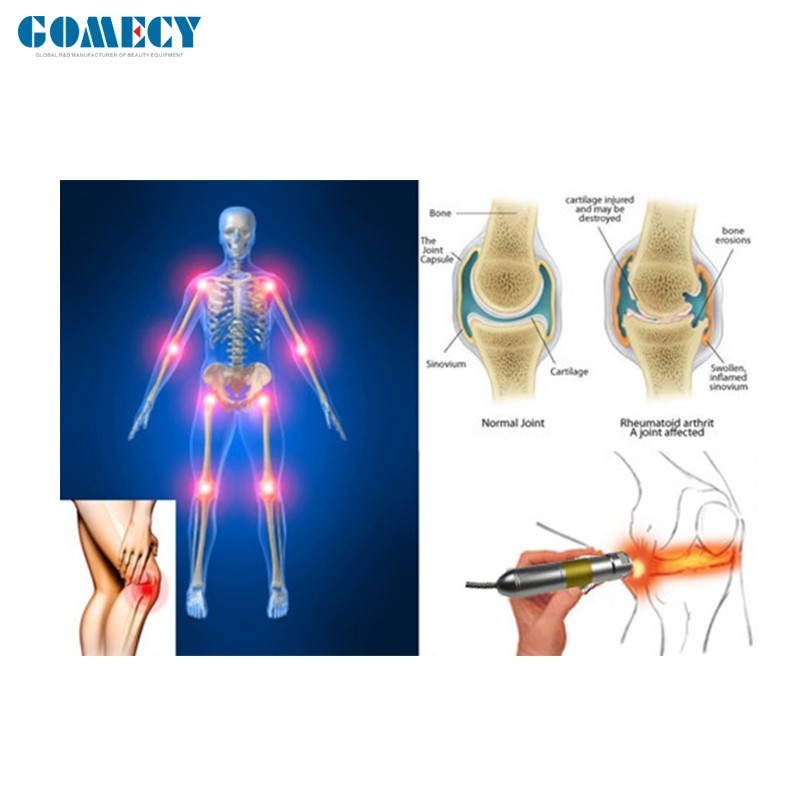 980nm 1470nm Vascular Removal Machine