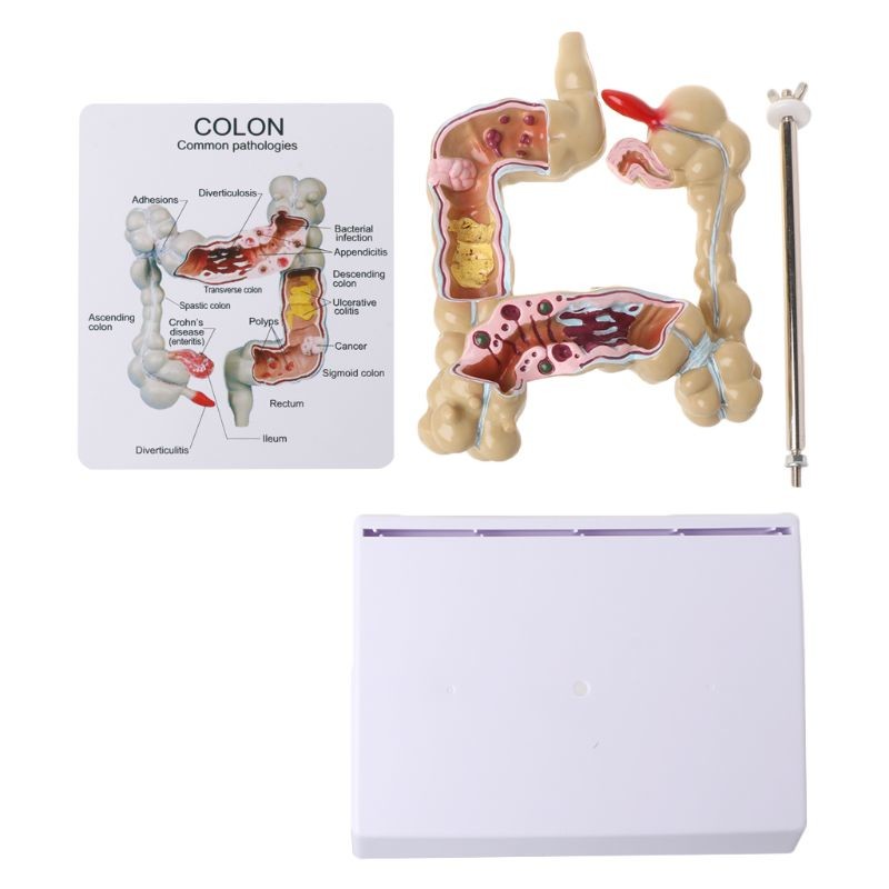 Advanced Medical Human Large Intestine Anatomy Model For School Hospital