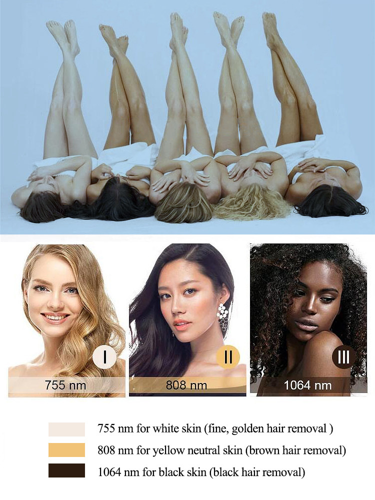 2000W Hair Removal Diode Laser 755 808 1064 / Diode Laser Hair Removal
