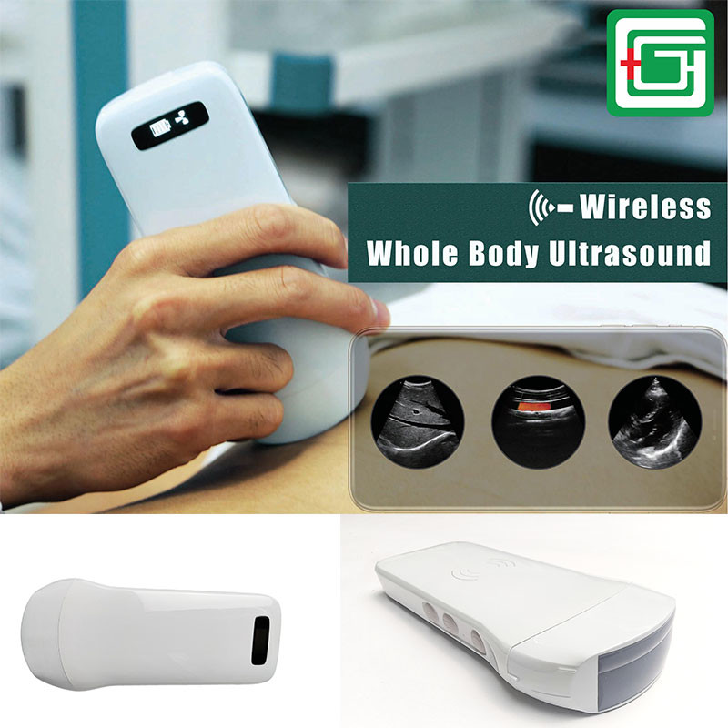 128 Elements Medical Hospital Equipments Color Doppler Portable Wireless Ultrasound Machine 3 In 1