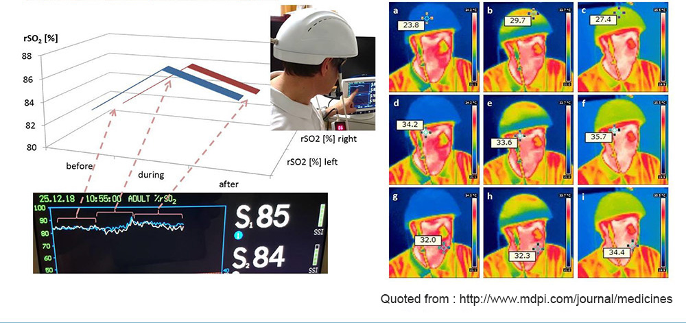 810nm Transcranial Magnetic Stimulation Neurofeedback Devices Physiotherapy
