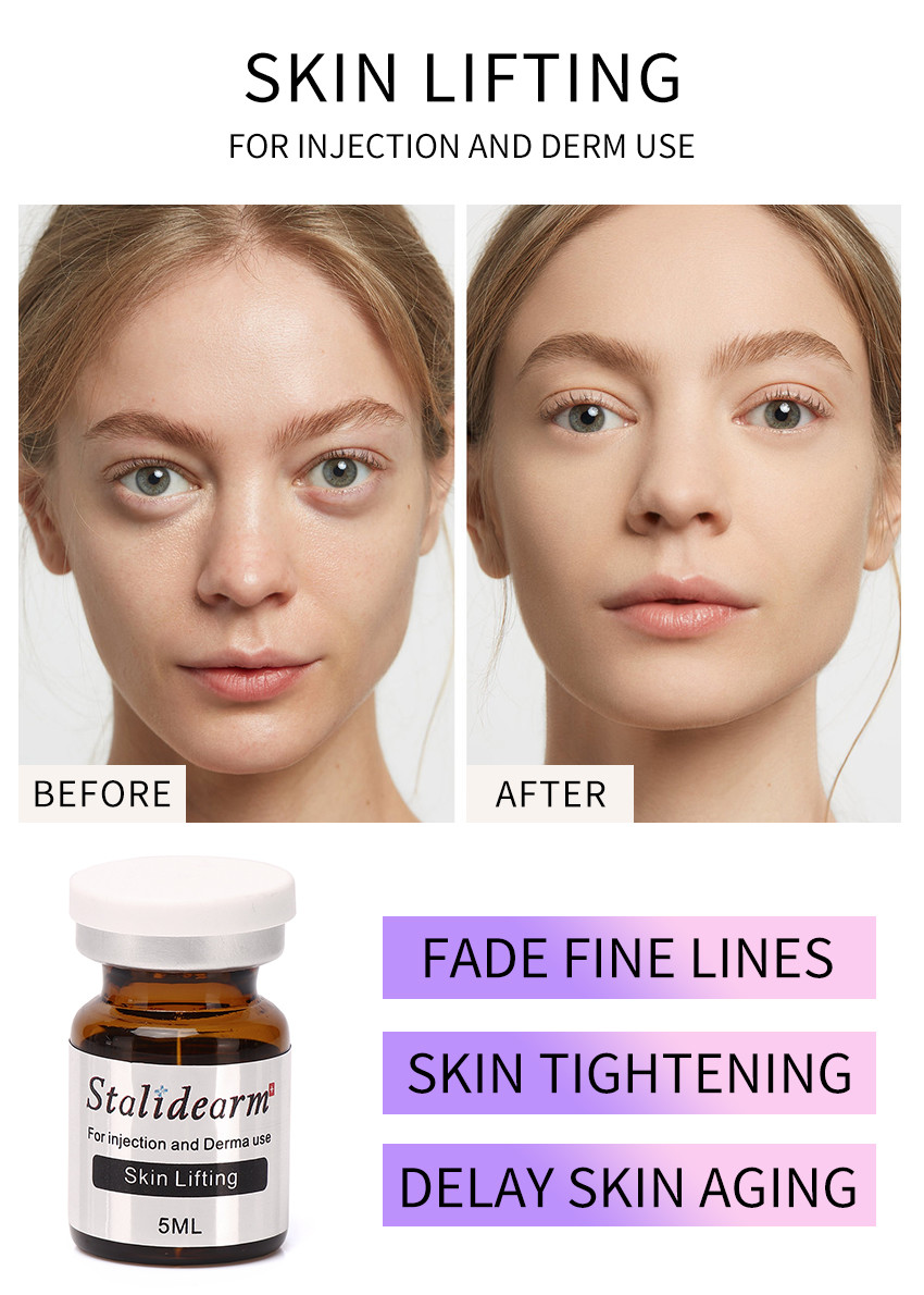 Stalideram Anti Aging Skin Lifting Injection Serum Injection Head Skin Care PRP natural good effect