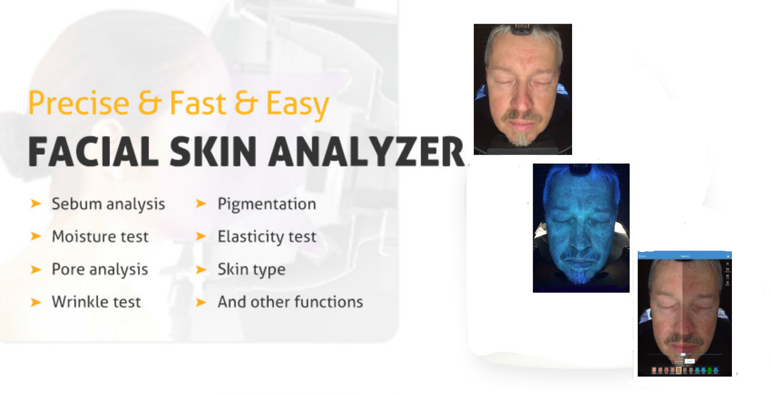 Portable Skin Analyzer Machine , Beauty Skin Testing Analysis Machine