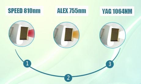 755/810/1064nm diode laser 808nm laser diode hair removal