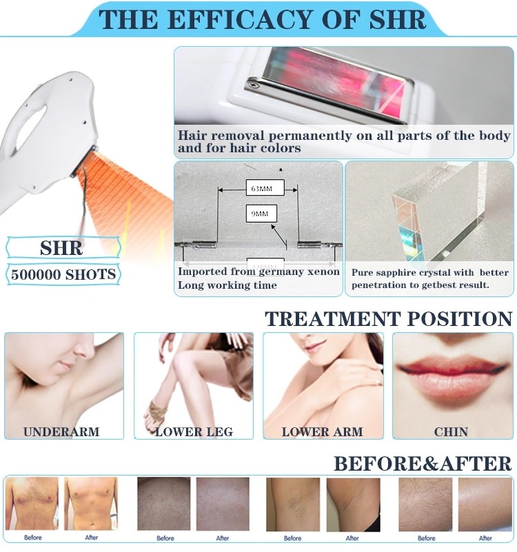 2018 multi-function big spot high energy best cooling system ipl elos shr ipl hair removal machine