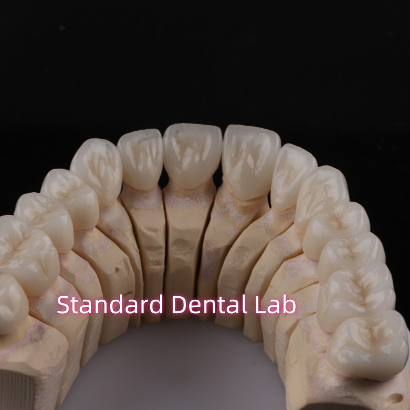 Digital CAD CAM Dental Lab PFZ Crowns Translucent Layered Zirconia Crown