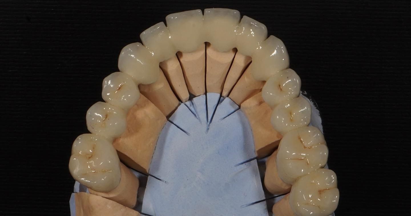 Good Fitting Good Esthetics Multi Layered Zirconia Crown Porcelain Zirconia Bridge