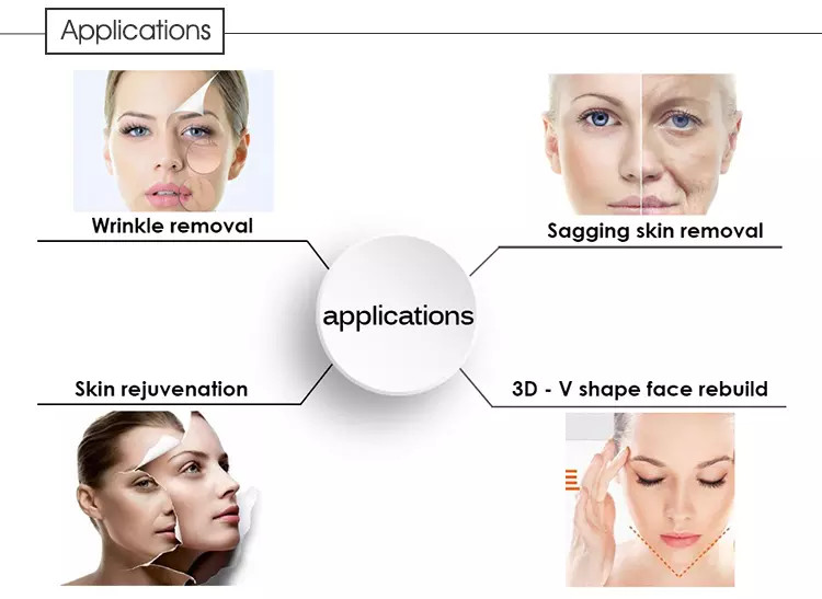 Quick Effect 9D Hifu Skin Tightening Machine For Sag Removal