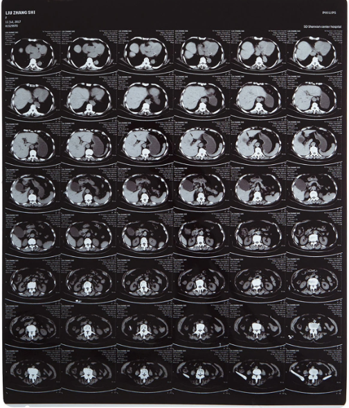 High-clarity Medical X Ray Film FUJI DIHT 14*17in Laser Dry Imaging Film