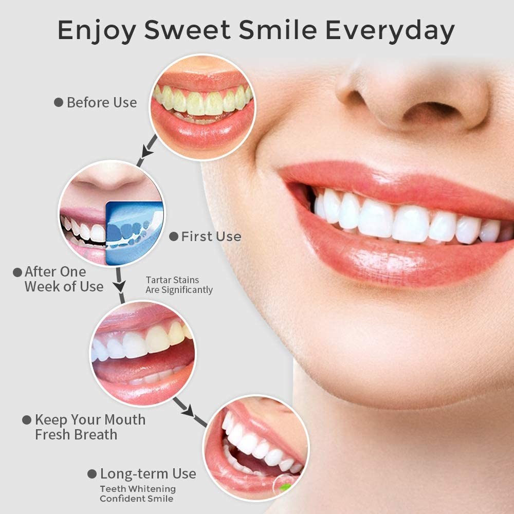 Portable Water Flosser Rechargeable Travel Irrigator Water Tank Irrigator Portable Oral Cleaning 5 Mode Dental Flosser